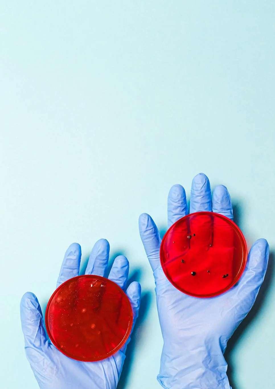 Formation en épidémiologie moléculaire